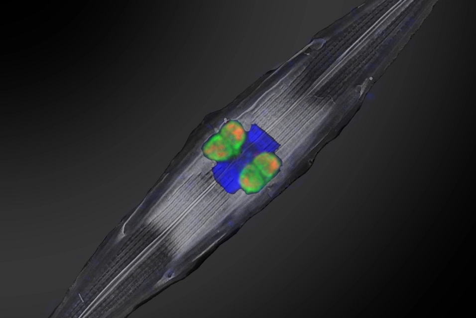 Image of a diatom with fluorescently labeled symbionts appearing in orange and green