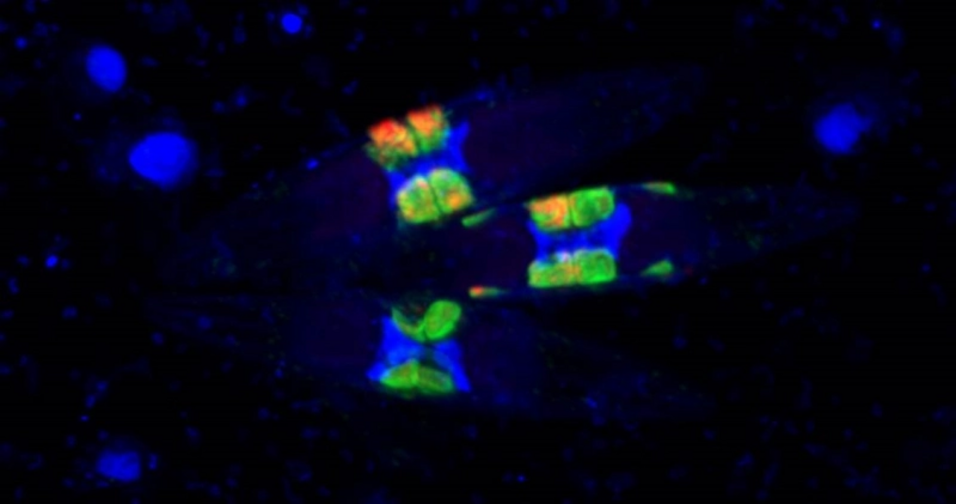 Image of three diatoms with fluorescently labeled symbionts appearing in orange and green