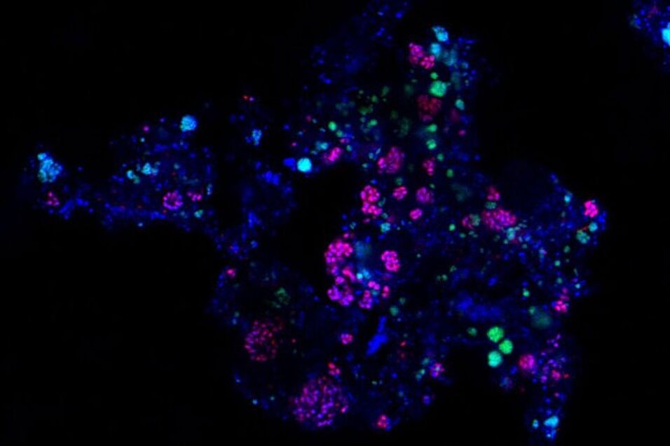 Activity-based labelling of comammox bacteria using the novel staining method